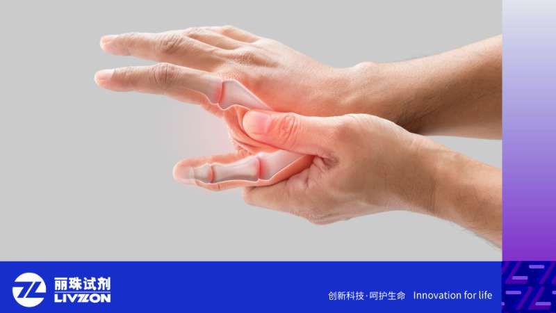 精准诊断时代——多指标联合检测成为RA诊疗的新范式